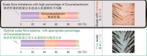 Absence of Corynebacterium